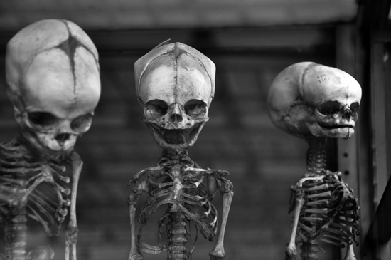 Baby Skeletons